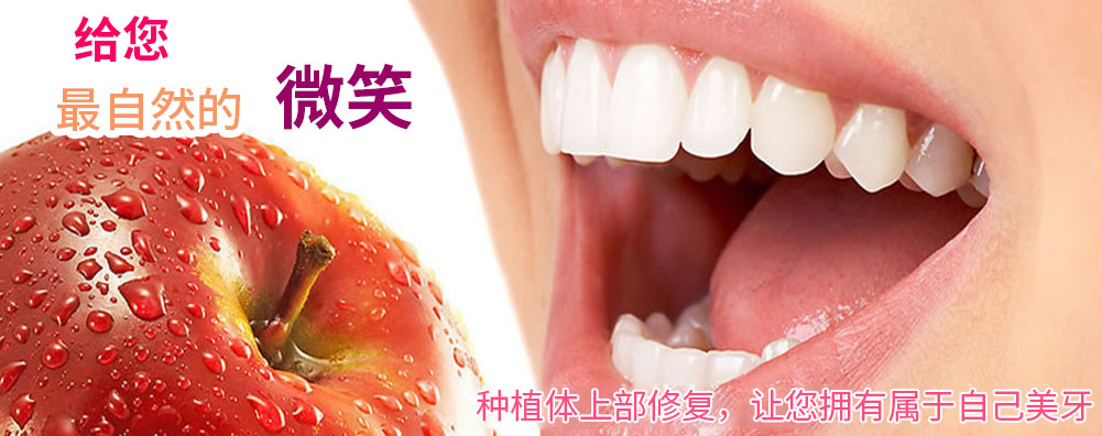 CNC加工鋁型材